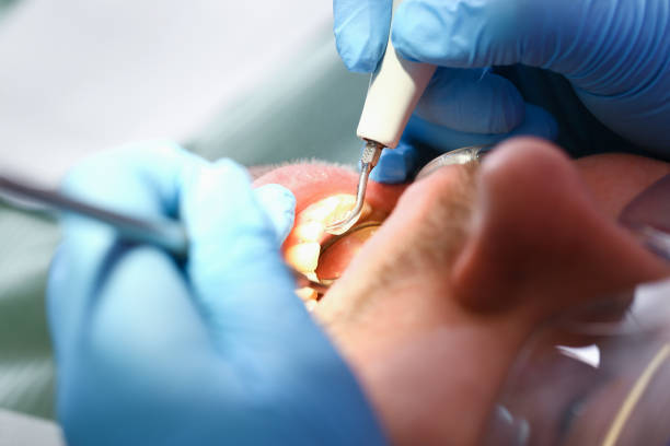 Dentist for Dental Trauma in ND