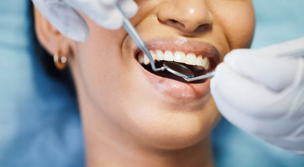 Best Root Canal Emergency Dentist  in Belcourt, ND